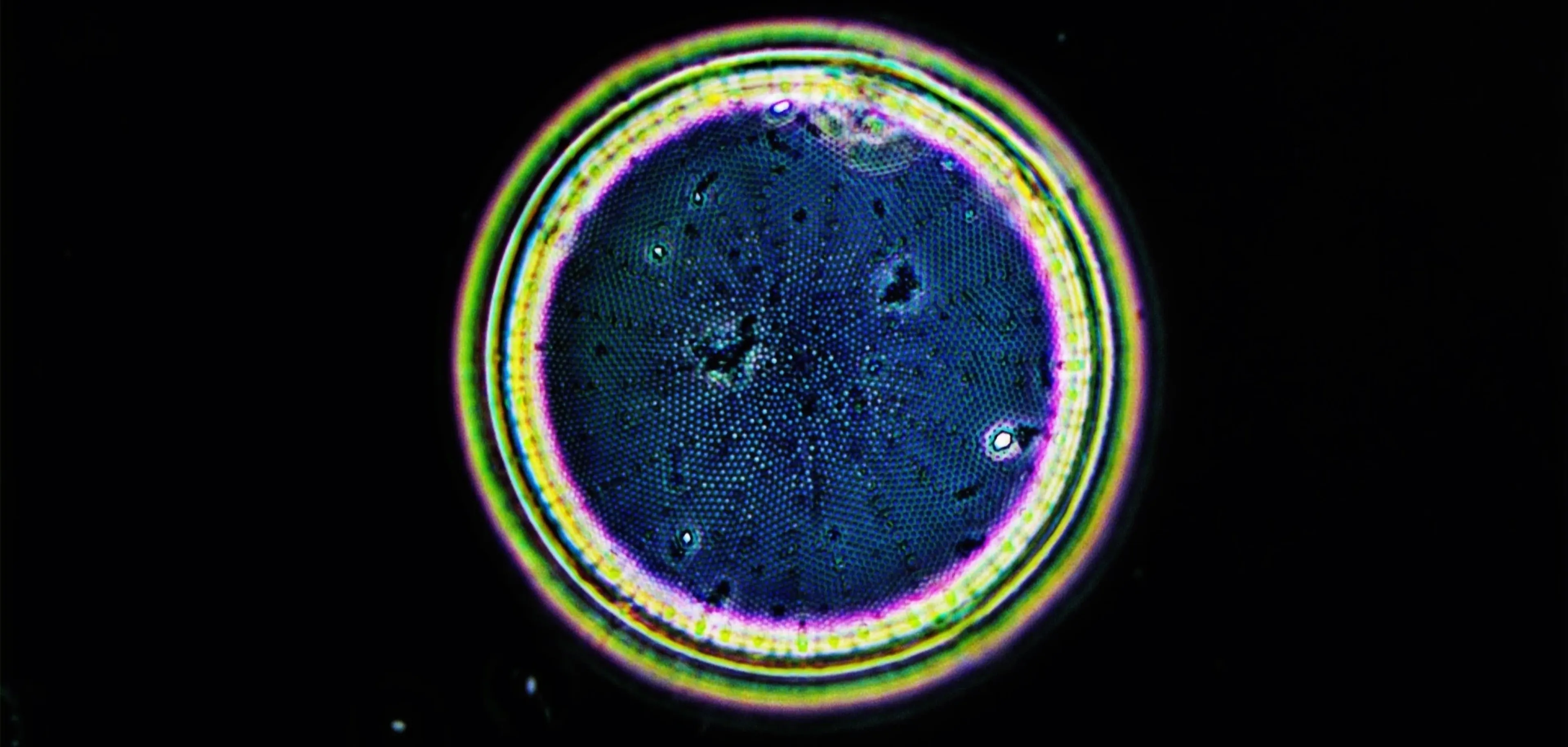 centric diatom of the Baltic Sea